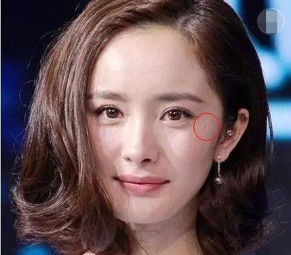 明星脸上疤痕,揭开他们勇敢面对挑战的印记